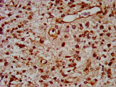 Polyclonal Rabbit anti-Human TOX Antibody (WB)