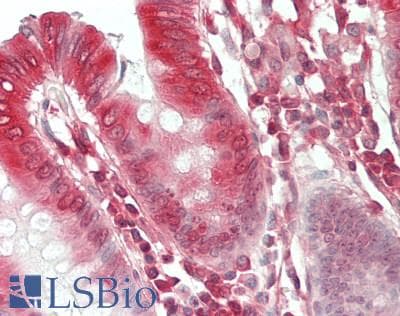 BRD2 / RING3 Antibody (aa675-725, clone 12C2E4)