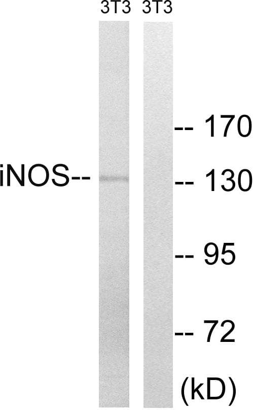 NOS2 / iNOS Antibody (p151)