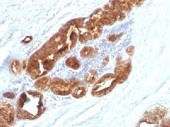 TAG-72 Antibody (clone CC49)