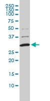 COMT Antibody (clone 1G4-1A1)
