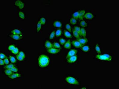 CCHCR1 Antibody