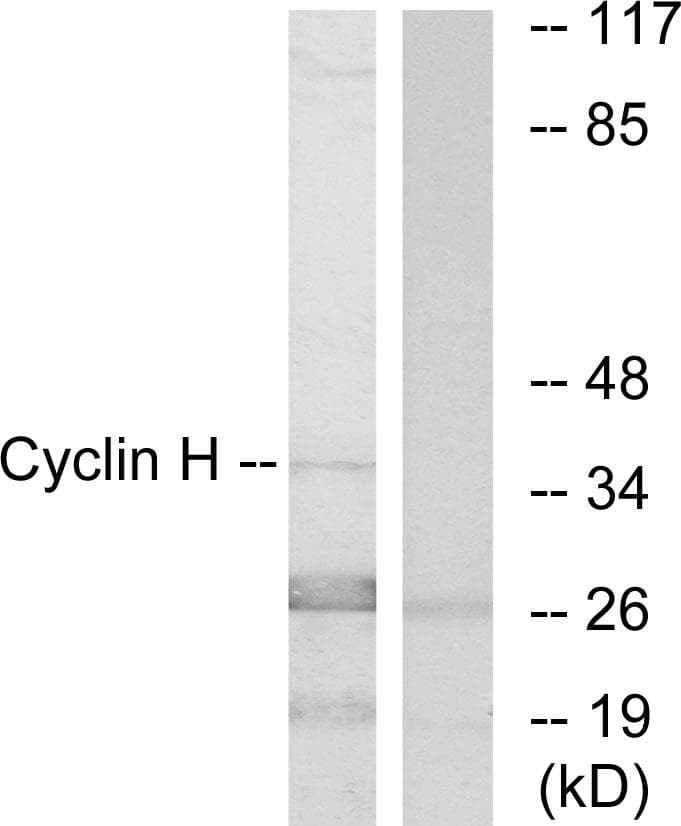 Polyclonal Rabbit anti-Human CCNH / Cyclin H Antibody (p315, IHC, IF, WB)