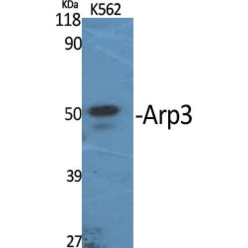 ACTR3 Antibody (340-420 aa, C-terminal)