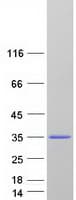 Human NAT15 Protein (Recombinant Myc-DDK (Flag))