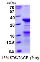 Human NPM2 Protein (Recombinant His)