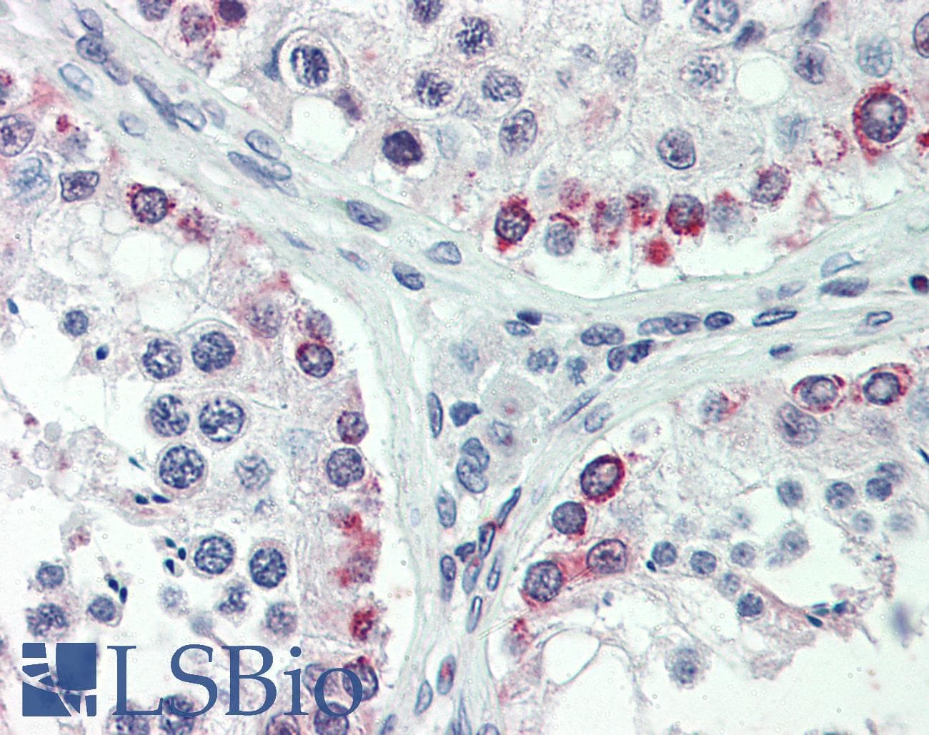 IHC-plus™ HDAC2 Antibody (N-Terminus)