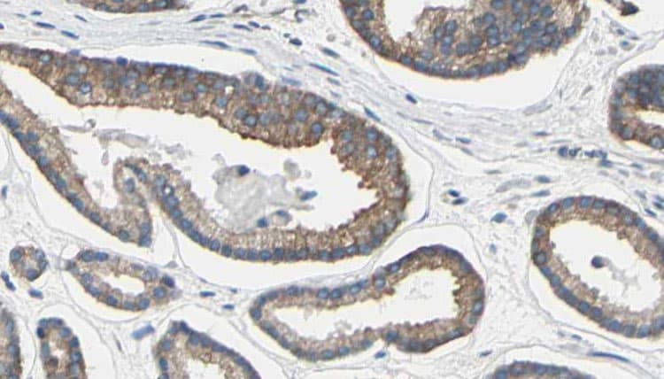Polyclonal Rabbit anti-Human BAAT / BAT Antibody (IHC, WB)