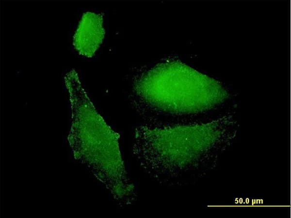 VAMP1 / VAMP-1 Antibody (clone 5A4)