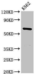 Polyclonal Rabbit anti-Human CDYL Antibody (IHC)