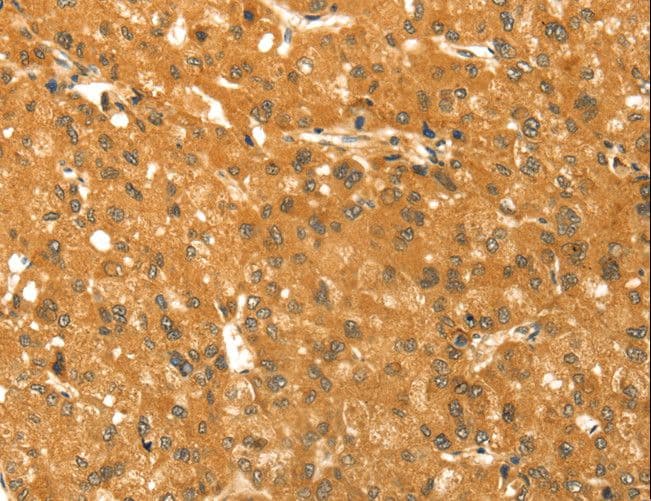 TM7SF2 Antibody