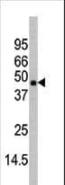 MAPK11 / SAPK2 / p38 Beta Antibody (aa334-359)