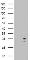 Monoclonal Mouse anti-Human ARFL3 / ARL3 Antibody (clone OTI1C6, aa2-182, IHC, WB)