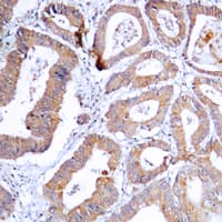 Polyclonal Rabbit anti-Human MEK1 + MEK2 Antibody (phospho-Ser218/Ser222, IHC, WB)