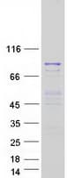 Human MSH5 Protein (Recombinant Myc-DDK (Flag))