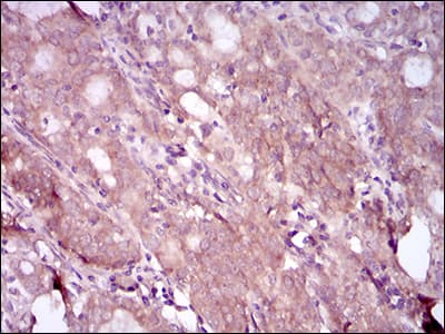 Monoclonal Mouse anti-Human EGFR Antibody (clone 5G9B5, aa693-893, IHC, WB)
