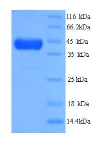 Human MS / MTR Protein (Recombinant His)