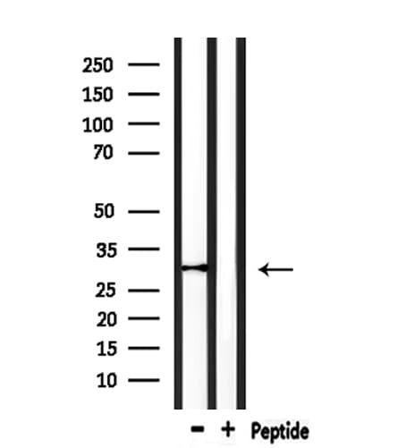 Polyclonal Rabbit anti-Human VTCN1 / B7-H4 Antibody (WB)
