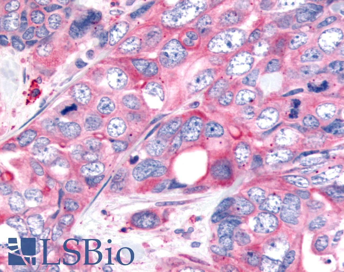 PathPlus™ WNT8A Antibody (Internal)