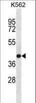 SEC14L4 Antibody (aa41-70)
