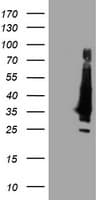 KCNJ3 / GIRK1 Antibody (clone OTI2F2)