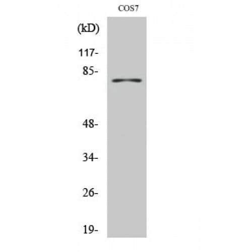 Polyclonal Rabbit anti-Human Tyrosinase Antibody (440-520 aa, C-terminal, WB)