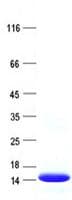 Human C5orf58 Protein (Recombinant His, N-Terminal)