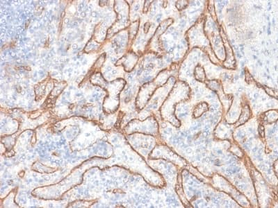 Recombinant Monoclonal Rabbit anti-Human CTNNB1 / Beta Catenin Antibody (clone CTNNB1/2030R, Azide-free,Carrier-free, IHC, IF, WB)