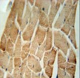Polyclonal Rabbit anti-Human Cardiolipin Synthase / CRLS1 Antibody (aa198-226, IHC, WB)