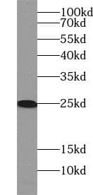 RPL29 / Ribosomal Protein L29 Antibody
