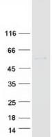 Human PPP2R3C Protein (Recombinant Myc-DDK (Flag))