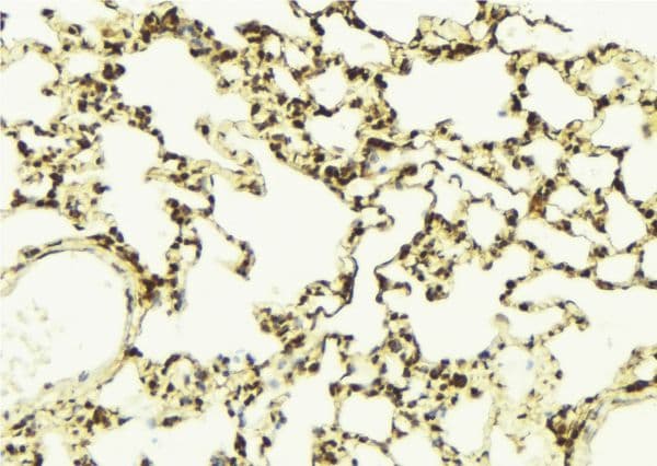 AURKB / Aurora-B Antibody