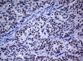NBN / Nibrin Antibody (aa183-460, clone OTI5E11, Carrier-free)
