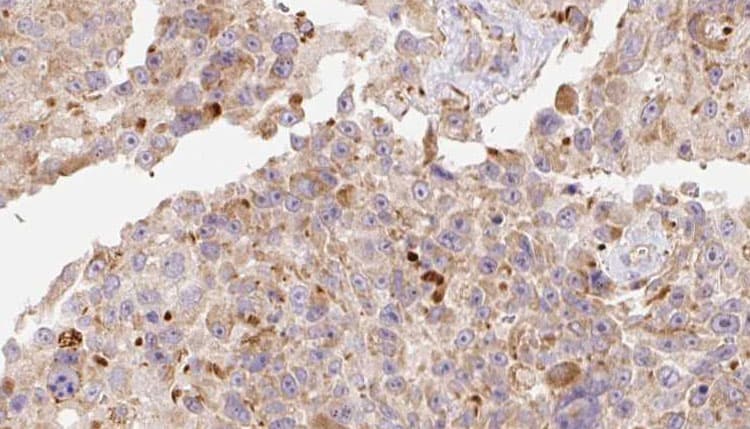 APOC3 / Apolipoprotein C III Antibody