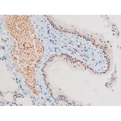 RELA / NFKB p65 Antibody (phospho-Ser281)