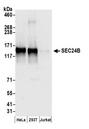 Polyclonal Rabbit anti-Human SEC24B Antibody (aa300-350, WB)