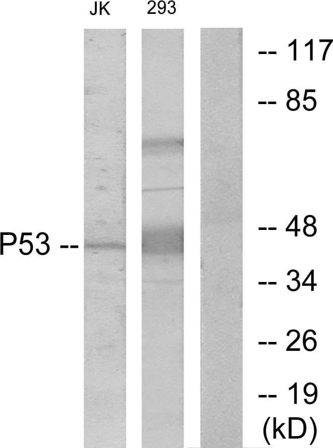 TP53 / p53 Antibody (aa1-50)