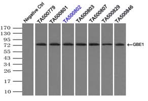 GBE1 Antibody (clone OTI5B7)