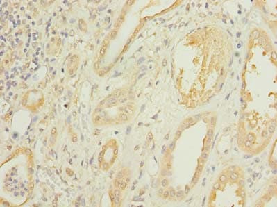 CMBL Antibody