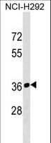 Polyclonal Rabbit anti-Human RPIA / RPI Antibody (aa181-207, WB)