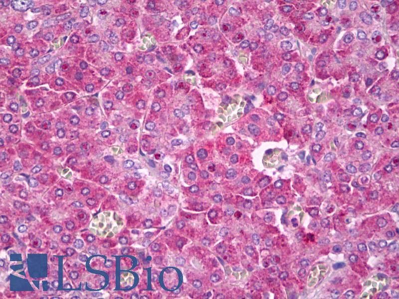 IHC-plus™ Polyclonal Rabbit anti-Human SCN1A / Nav1.1 Antibody (IHC, WB)
