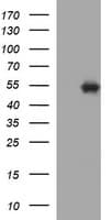 Monoclonal Mouse anti-Human TUBB1 / Tubulin Beta 1 Antibody (clone OTI1B9, WB)
