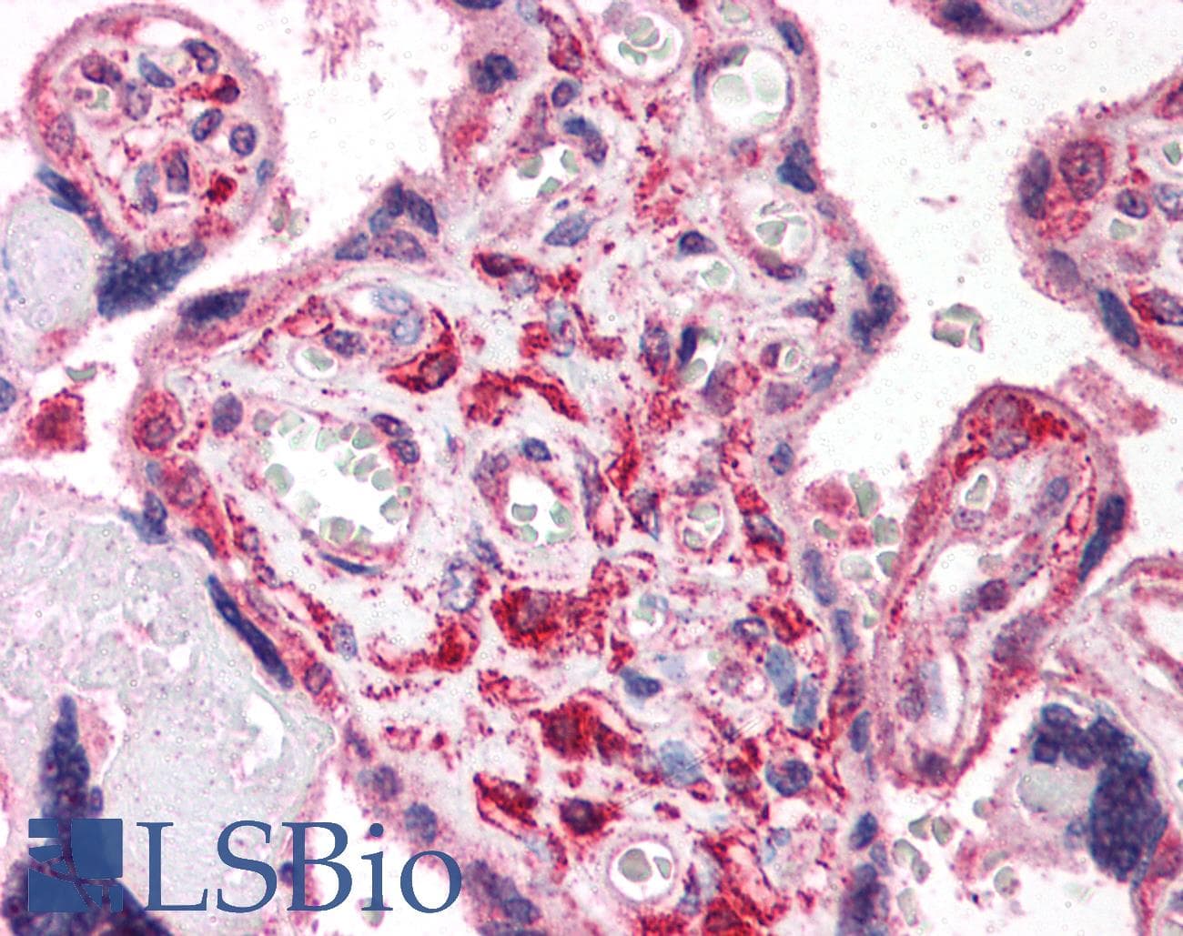 IHC-plus™ HIF1A / HIF1 Alpha Antibody (aa530-825)