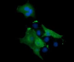 MAP2K1 / MKK1 / MEK1 Antibody (clone OTI1F4)
