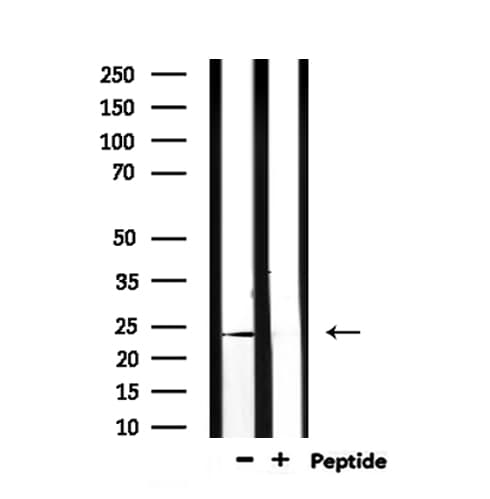 PGF / PLGF Antibody