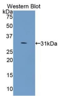 COL4A5 / Collagen IV Alpha5 Antibody (aa1461-1685)