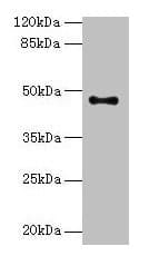 Polyclonal Rabbit anti-Human AADACL2 Antibody (WB)
