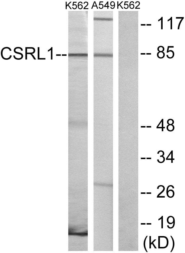 VN2R1P Antibody