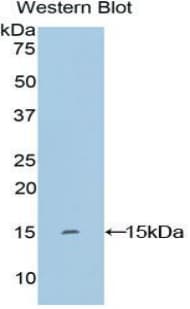 KRT2 / CK2 / Cytokeratin 2 Antibody (aa7-160, FITC)