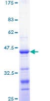 Human CTNNB1 / Beta Catenin Protein (Recombinant GST, N-terminus)